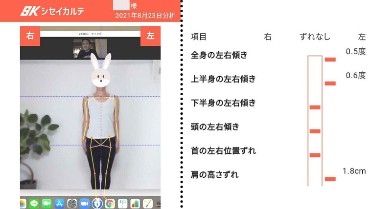 Live Fit(ライブフィット)の姿勢分析 ダイエット オンラインパーソナルトレーニング